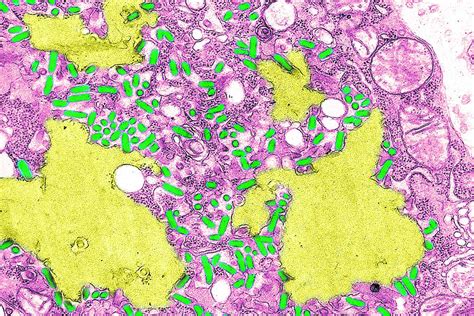 Improved rabies vaccine could be better and cheaper | New Scientist