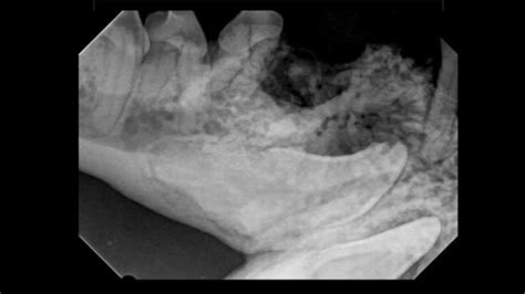 Veterinary Dentistry Case Dentigerous Cyst Excision In A Dog Youtube