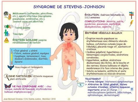 Syndrôme De Ste Jean Johson Maladie Enfant Maladie Infantile Santé