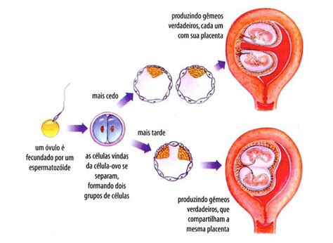 A Fecundação Ocorre Nas Tubas Uterinas