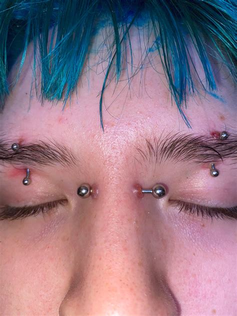 Whats Wrong With My Bridge Piercing Rejection My Eyebrows As Well But Ive Had Them Pierced
