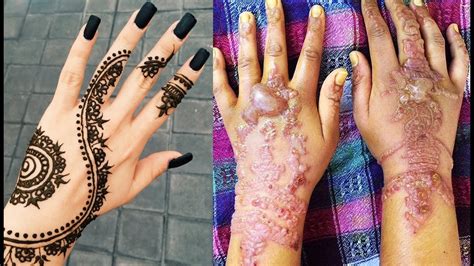 are black henna tattoos permanent the dangers of black henna tattoos on holiday by 77 the hill