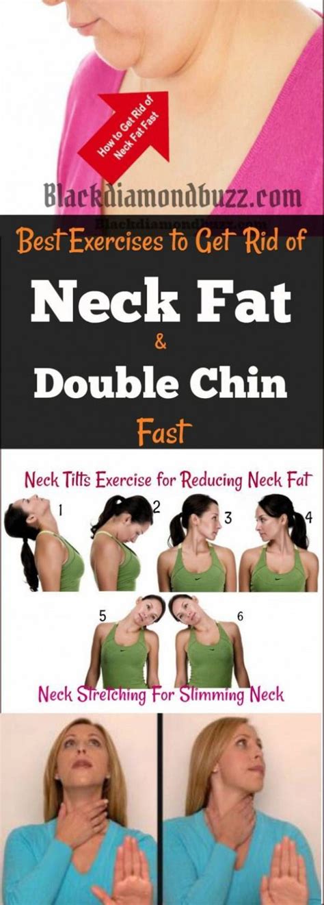 List Of How To Get Rid Of Fatty Neck Hump Fast Ideas