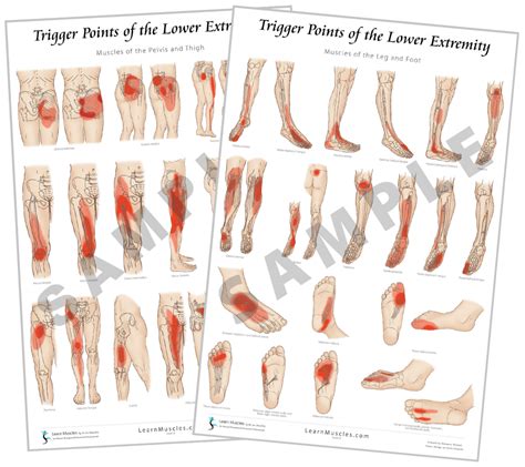 Trigger Point Lower Extremity 24 X 36 Premium Poster 2 Pack Pre