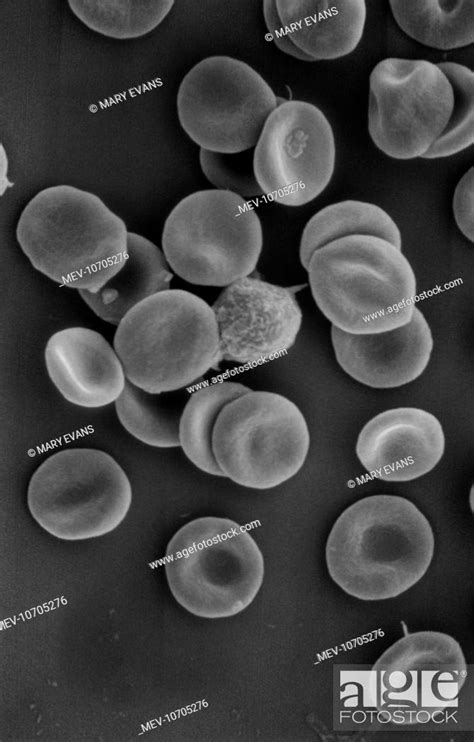 Electron Microscope Blood Cells Micropedia