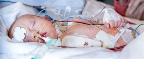 Pediatric Cardiac Surgery Experts And Specialists In Germany