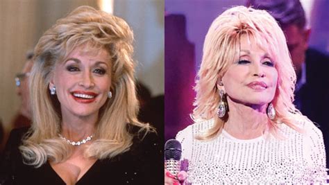 Dolly Parton Before And After Weight Loss