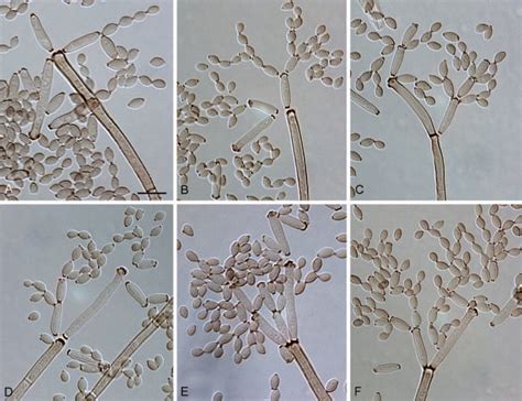 Cladosporium Cladosporioides Alchetron The Free Social Encyclopedia