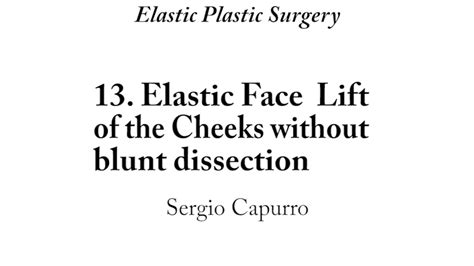 13 Elastic Face Lift Without Blunt Dissection On Vimeo