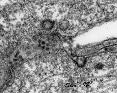 Public Domain Picture Transmission Electron Micrograph Of West Nile Virus Id