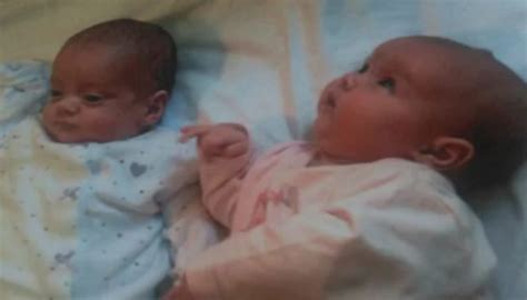 remarkable miracle twins born 87 days apart got into the guinness book of records