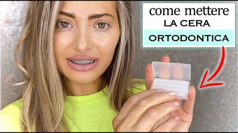 COME METTERE LA CERA ORTODONTICA YouTube