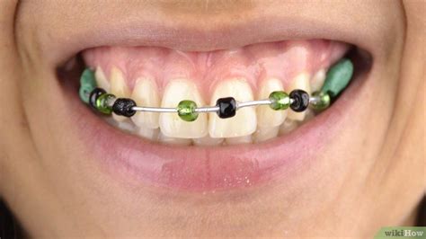 How To Make Fake Braces 11 Steps With Pictures Fake Braces Diy Braces Diy Teeth Straightening