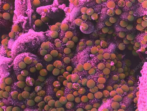 It is capable of causing disease both in immunocompetent and immunocompromised hosts. Cryptosporidium parvum parasites, SEM - Stock Image - M112 ...