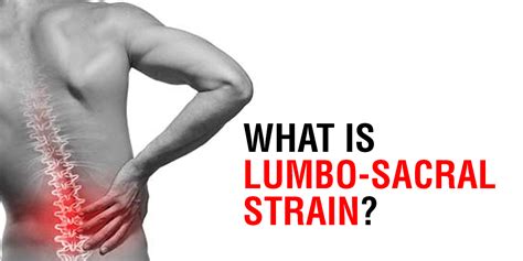 Lumbo Sacral Strain Understanding And Managing The Most Common Cause