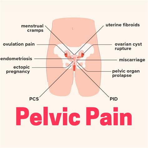 Pelvic Pain Inspira Physical Therapy And Pilates