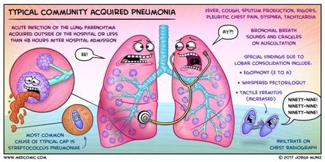 What Are The 4 Stages Of Pneumonia Medical Jobs
