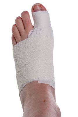 Turf toe refers to an injury that affects the ligaments around a person's big toe. Turf Toe Taping | Physical Sports First Aid Blog