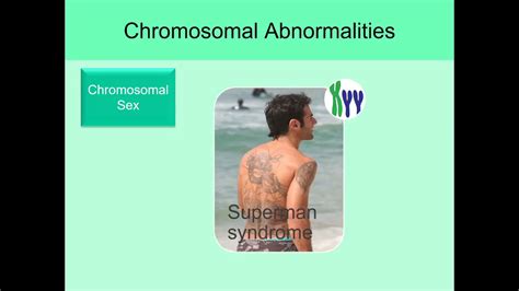 Ch 51 Human Sexuality Chromosomal Abnormalities Youtube