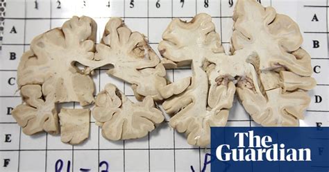 A Human Brain Dissection In Pictures Science The Guardian