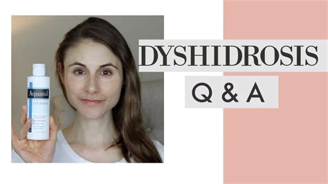 Dyshidrosis Qanda With Dermatologist Dr Dray Youtube