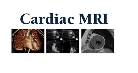 Cardiac Mri Stress Cardiac Perfusion Mri Or Chest Mri