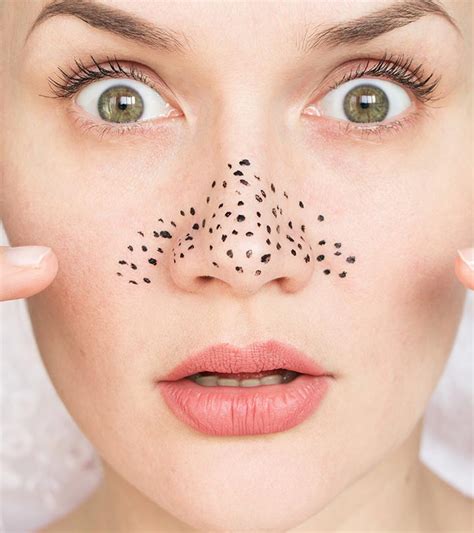 That's not to say they can't appear on your st. 10 Best DIY Blackhead Removal Face Masks