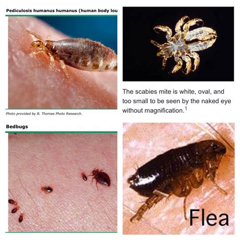 Fleas are very good at hiding on cat's. Bed Bugs Vs Scabies | Moreoo