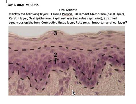 Solved Oral Mucosa Identify The Following Layers Lamina