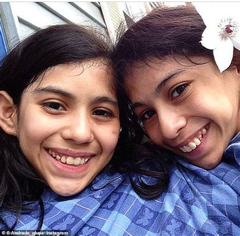 Viewers Praise Inspirational Conjoined Twins 18 Who Refused To Be Separated Daily Mail Online