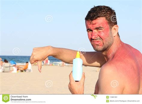 Man Getting Sunburned At The Beach Stock Image Image Of Painful