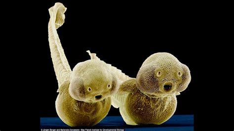 Amazing Deep Sea Microscopic Alien Entities ~ Beautiful Small Creatures