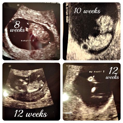 Pregnancy Update Baby At 12 Weeks Our Knight Life