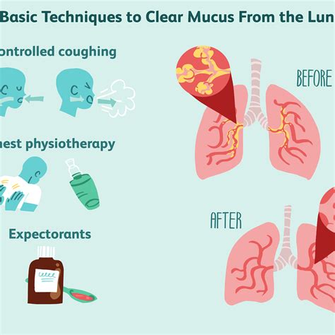 How To Drain Mucus From Your Lungs Best Drain Photos Primagem Org