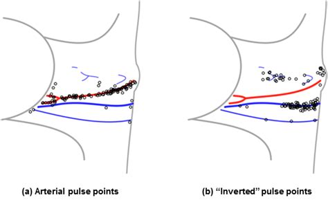 Non Contact Hemodynamic Imaging Reveals The Jugular Venous Pulse