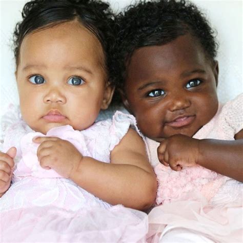 Twins Born With Different Color Skintones Win Over Our Hearts Proving