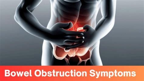 Bowel Obstruction Symptoms Unmasking The Hidden Signs Of Intestinal Distress