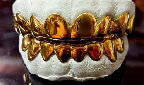18k Gold Grillz Palacios Jewelers