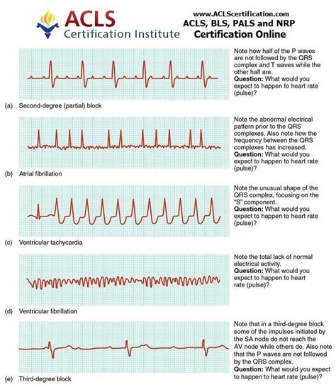 Ekg Whos Naturally Good At Em No One Its Learned And Needs