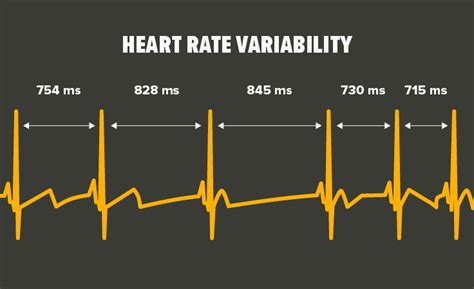 Top 10 What Is Heart Rate Variability 2022