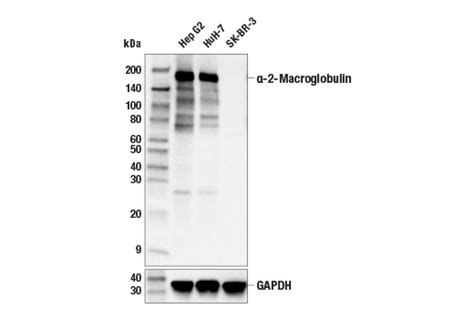 α 2 Macroglobulin E6n7x Rabbit Mab Cell Signaling Technology