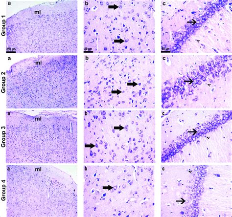 Histopathological Evaluation Of Brain Tissues Light Microscopic Image