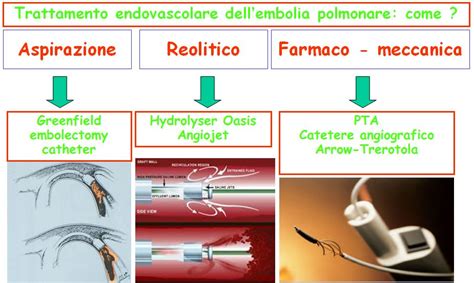I nostri esperti hanno risposto a 8 domande su embolia polmonare. Embolia polmonare: strategie e materiali per il ...
