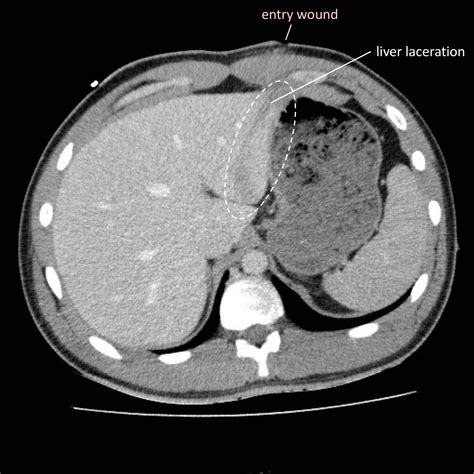 Radiology Cafe
