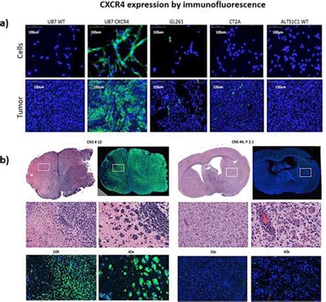 Cxcr4 Expression By Immunofluorescence Immunofluorescence Staining For