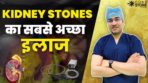 Kidney Stone का सबसे अच्छा इलाज | Best Treatment for Kidney Stones