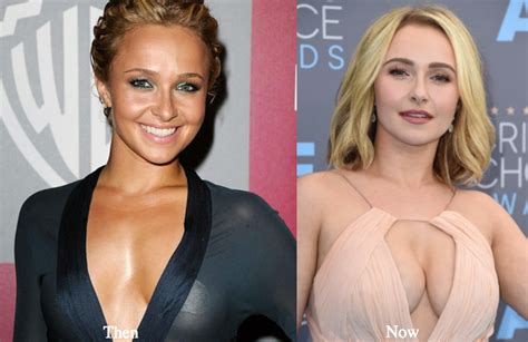 Hayden Panettiere Plastic Surgery Before And After Photos