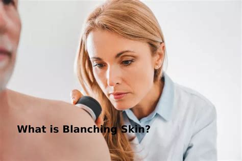 What Is Blanching Skin