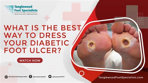 What Is The Best Way To Dress Your Diabetic Foot Ulcer Diabetes