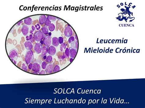 Le leucemie croniche sono più caratteristiche dell'età adulta. Leucemia Mieloide Crónica by Instituto del Cáncer SOLCA ...